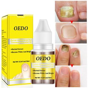 [100% original + bacalao + stock listo] Oedo Herbal Antibacterial Nail Treatments Essential Oil