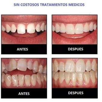 Brackets No Fijos Solumatica Corrector Dental D1 Blanco Linio Peru So340hb0glx6ylpe