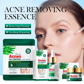 Tratamiento anti acné extracto Té verde 3 en 1