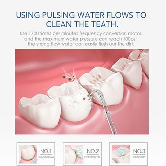 Irrigador Oral de agua Dental Flosser Ortodoncia Fuerte lse Oral Elimi 